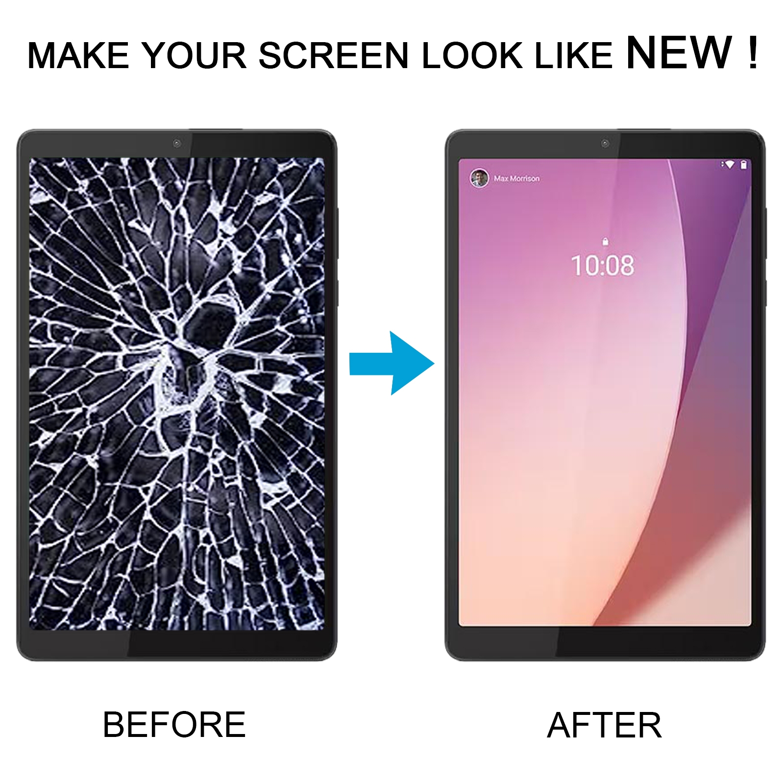 Lenovo Tab M8 4th Gen Black Screen Replacement - Image 5
